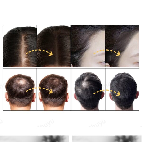 019f0d2e 9c71 4e4c 92b6 cfa2ce91847a 600x600