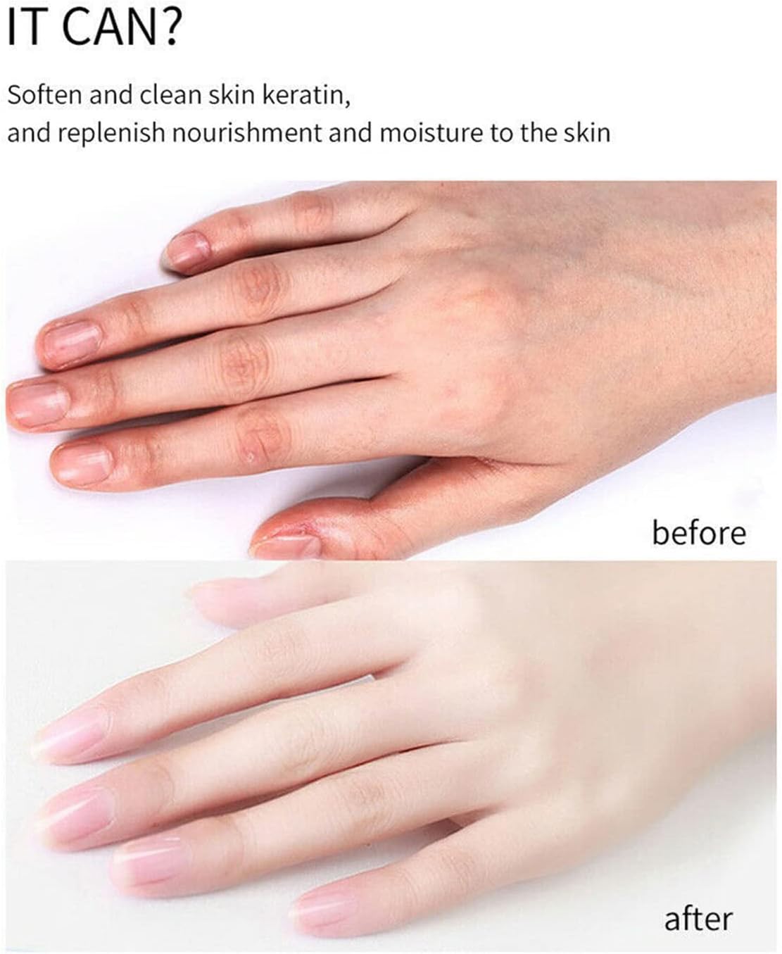 زيت تقشير الجلد الميت السحري الصورة 7