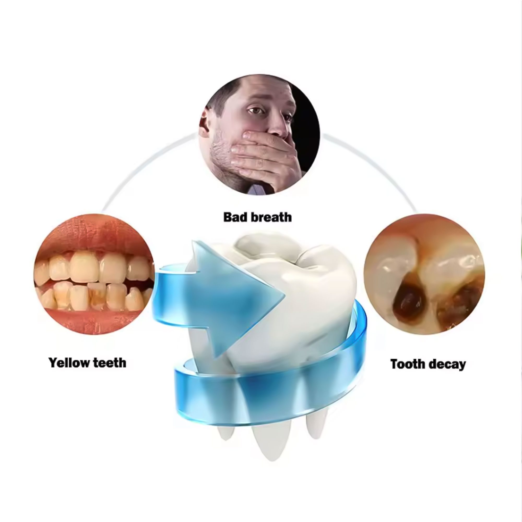 جهاز تنظيف الأسنان الأوتوماتيكى + جل التبييض الفورى الصورة 3