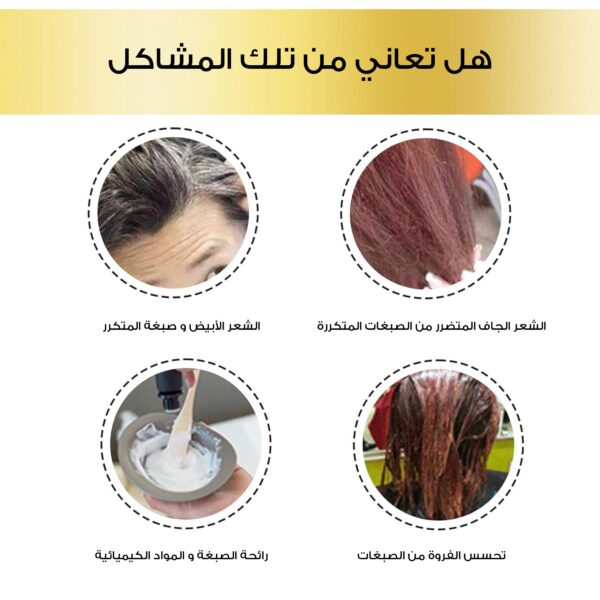 4de7a941 a82c 4c2d b7bd 226333653f45 600x600