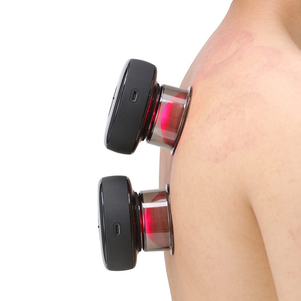 جهاز الحجامة الكهربائي