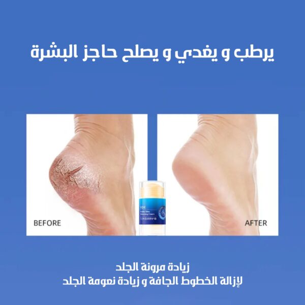 عرض 4 ستيك مرطب لليدين والقدمين  أزرق