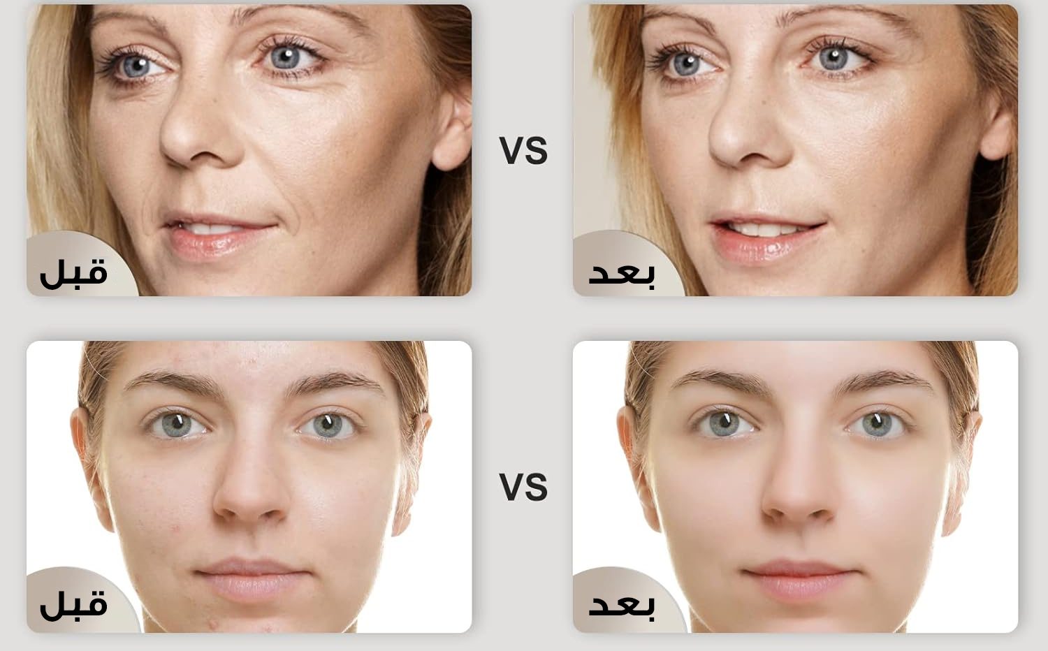 جهاز ليزر لبشرة زجاجية الصورة 2