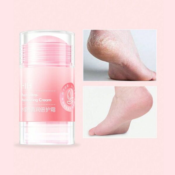 • ستيك مرطب لليدين والقدمين  بينك